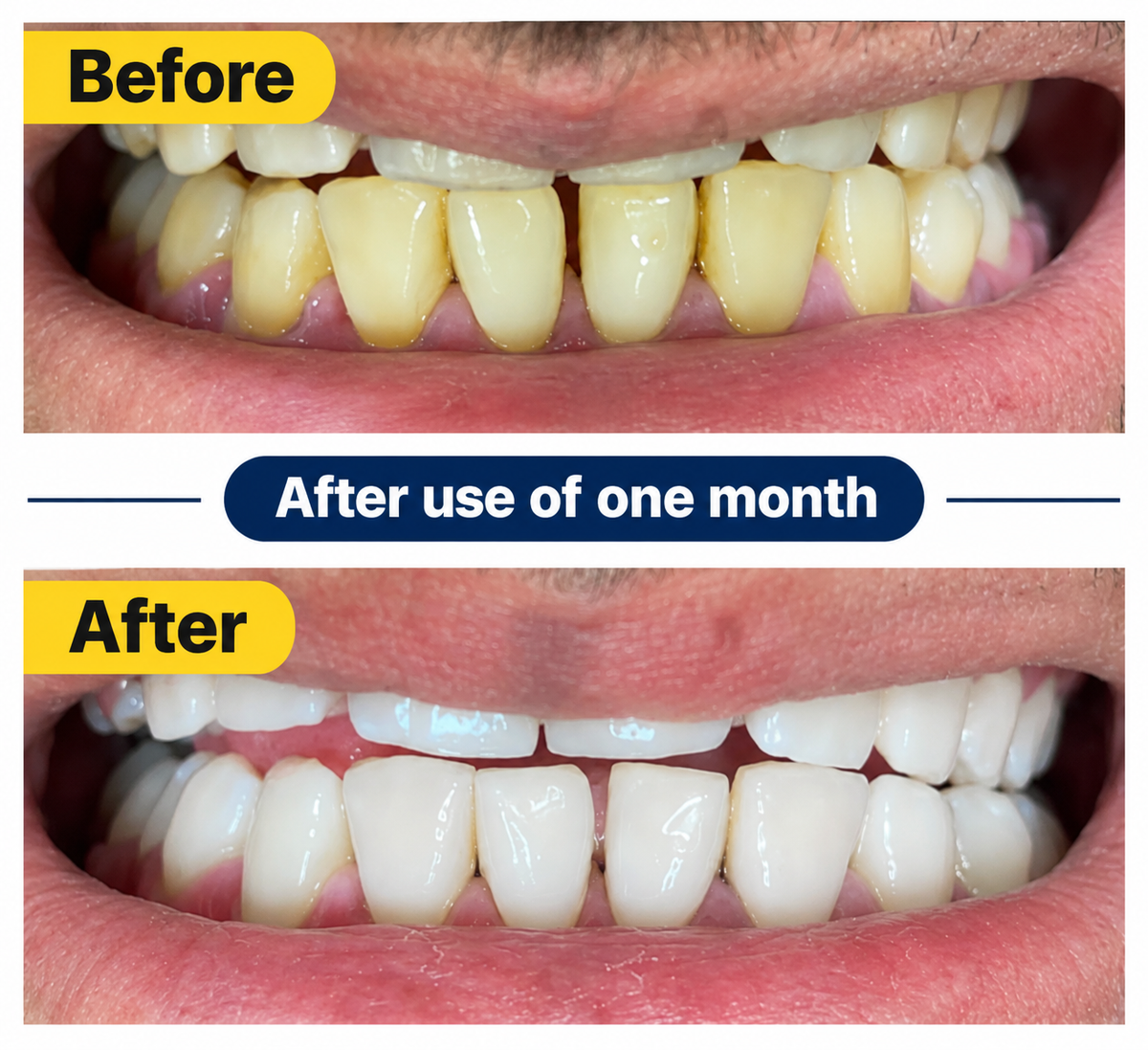 Teeth Whitening Powder – Natural Herbal & Miswak Formula for Sparkling White Teeth | High Glow Beauty