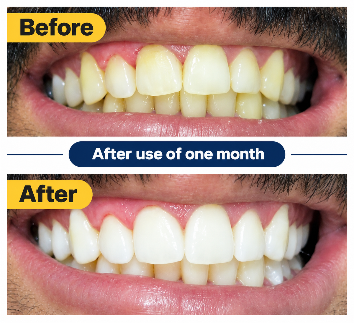 Teeth Whitening Powder – Natural Herbal & Miswak Formula for Sparkling White Teeth | High Glow Beauty